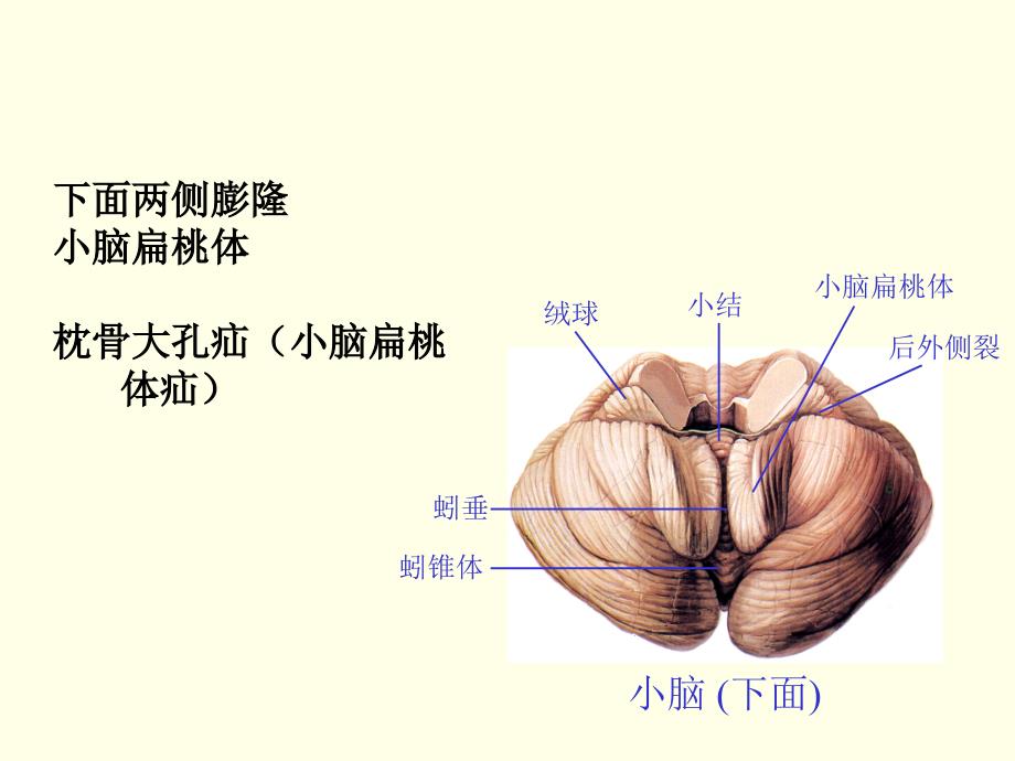 医学人体解剖学资源：小脑_第4页