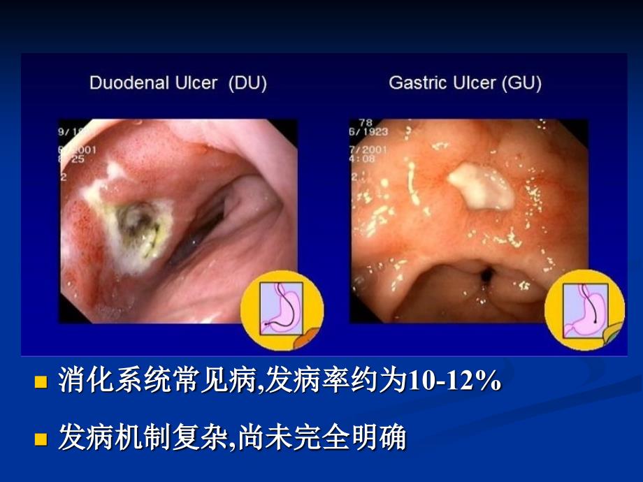 《消化系统药理》PPT课件_第4页