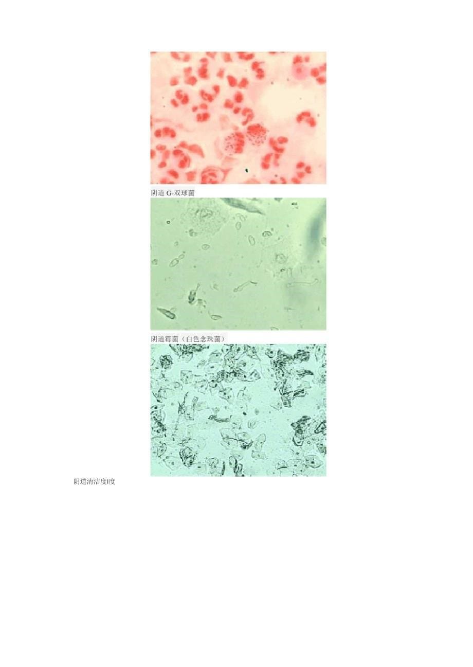 白带常规化验单有如下5个检测项目_第5页