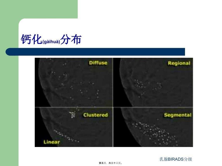 乳腺BIRADS分级课件_第5页