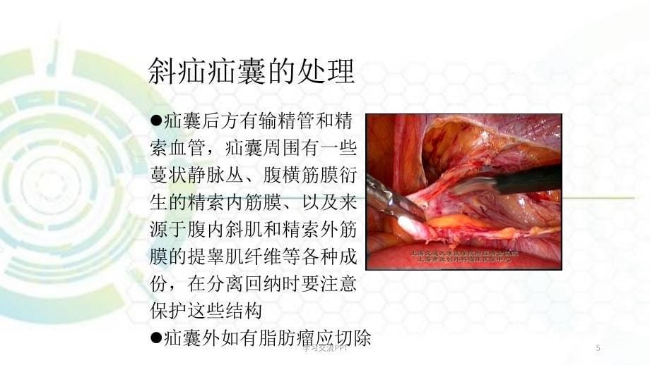 TAPP手术技巧课件_第5页