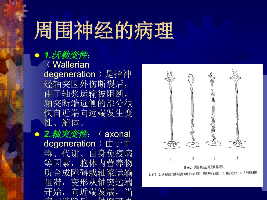 周围神经病吉大二院ppt课件_第4页