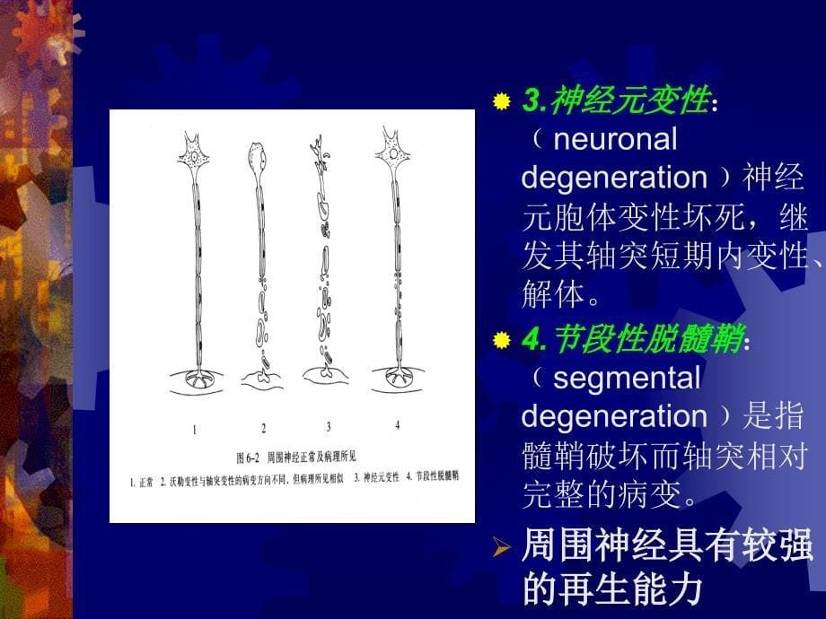 周围神经病吉大二院ppt课件_第5页