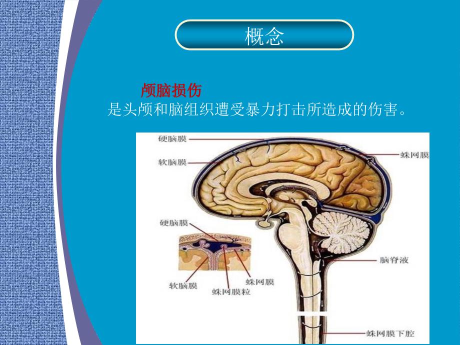 重型颅脑损伤护理查房课件_第4页