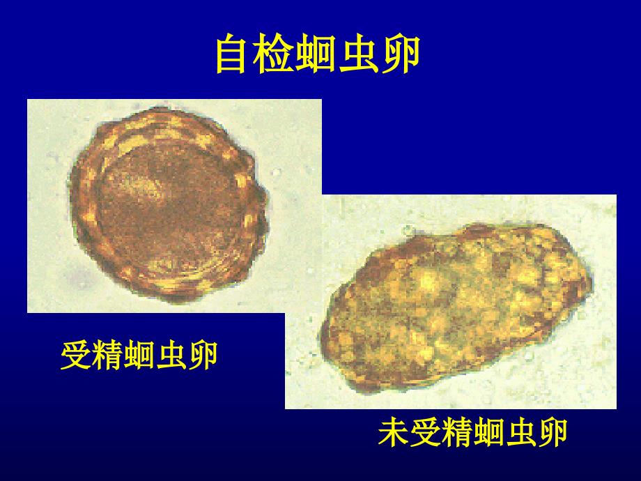 线虫和绦虫实验_第4页