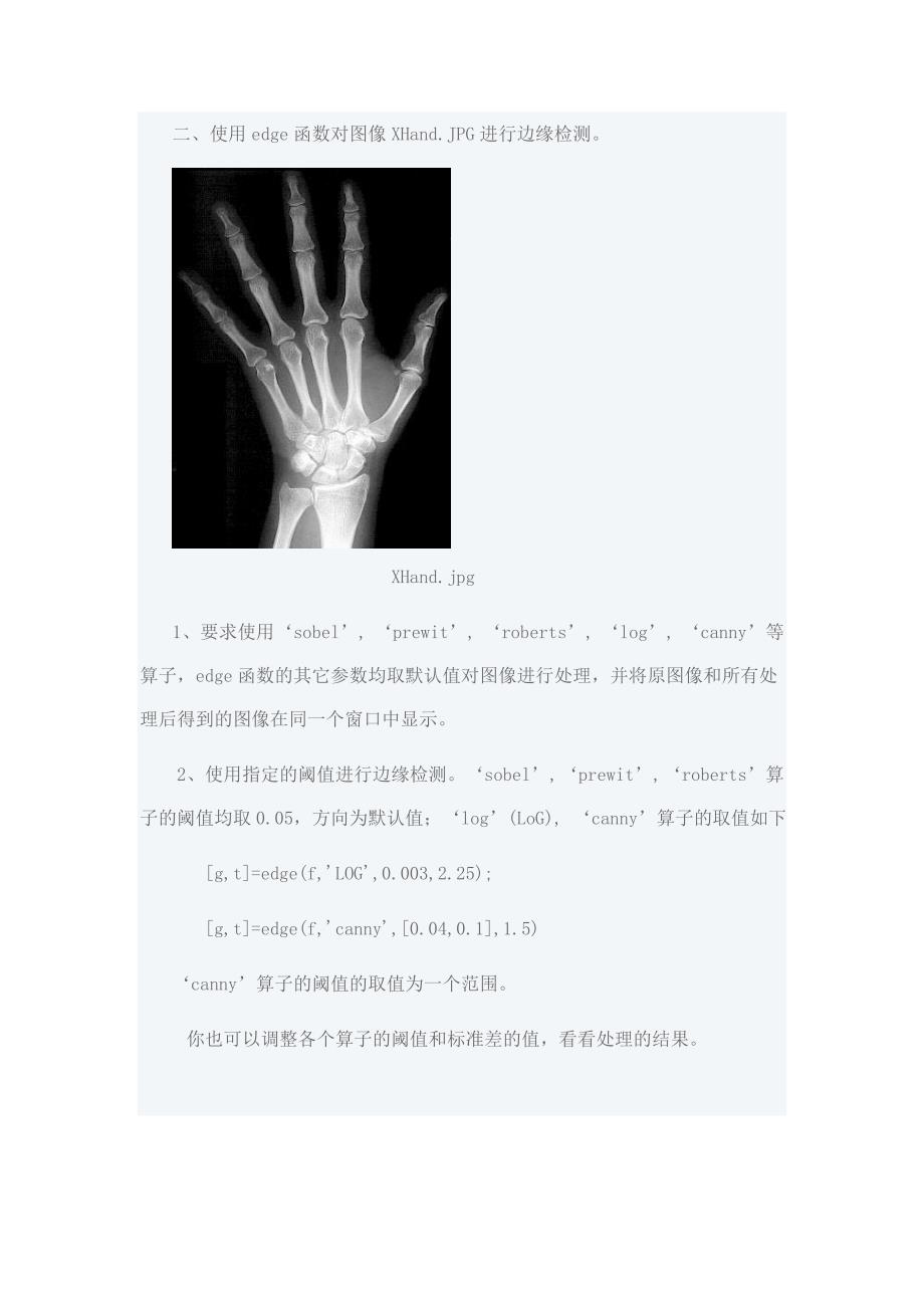 实验八 医学图像分割----基于梯度算子的边缘检测.doc_第2页