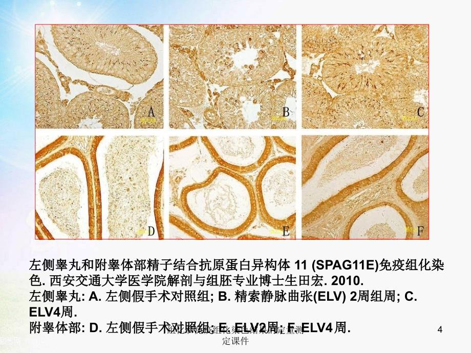 组化和免疫组化染色结果的定量测定课件_第4页