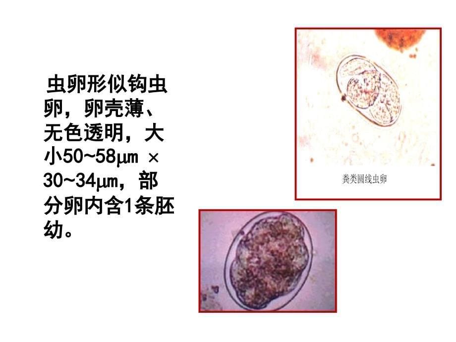 粪类圆线虫课件_第5页