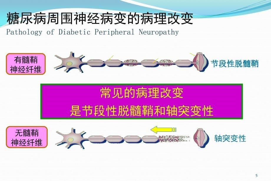 糖尿病周围神经病变课件_第5页