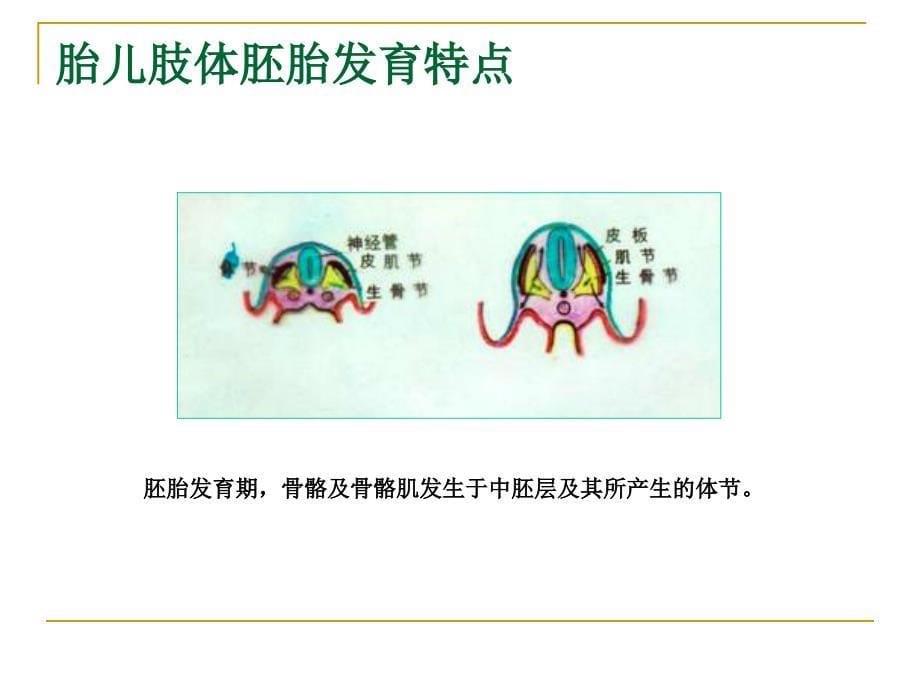 胎儿骨骼肢体畸形超声.ppt_第5页