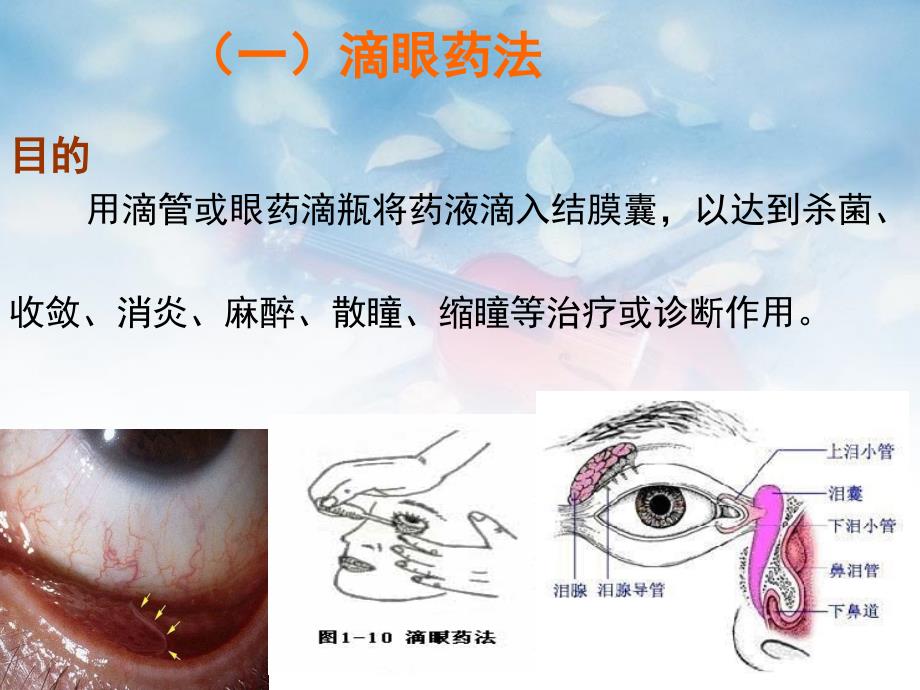 局部给药法_第3页