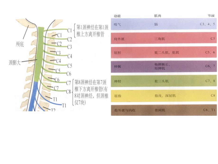 颈椎骨折课件_第3页