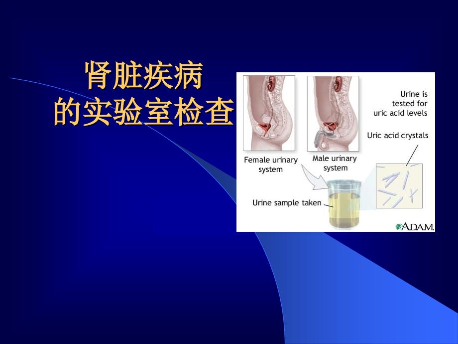 肾脏疾病的实验室检查_第1页