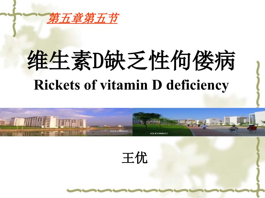 RicketsofVitDDeficiency非临床_第1页