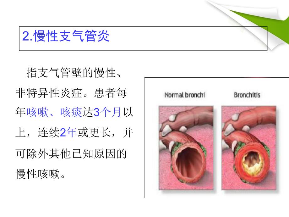 COPD-慢性阻塞性肺气肿解读_第4页