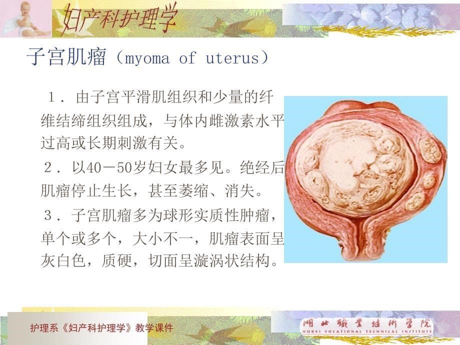 女性生殖系统肿瘤课件_第5页