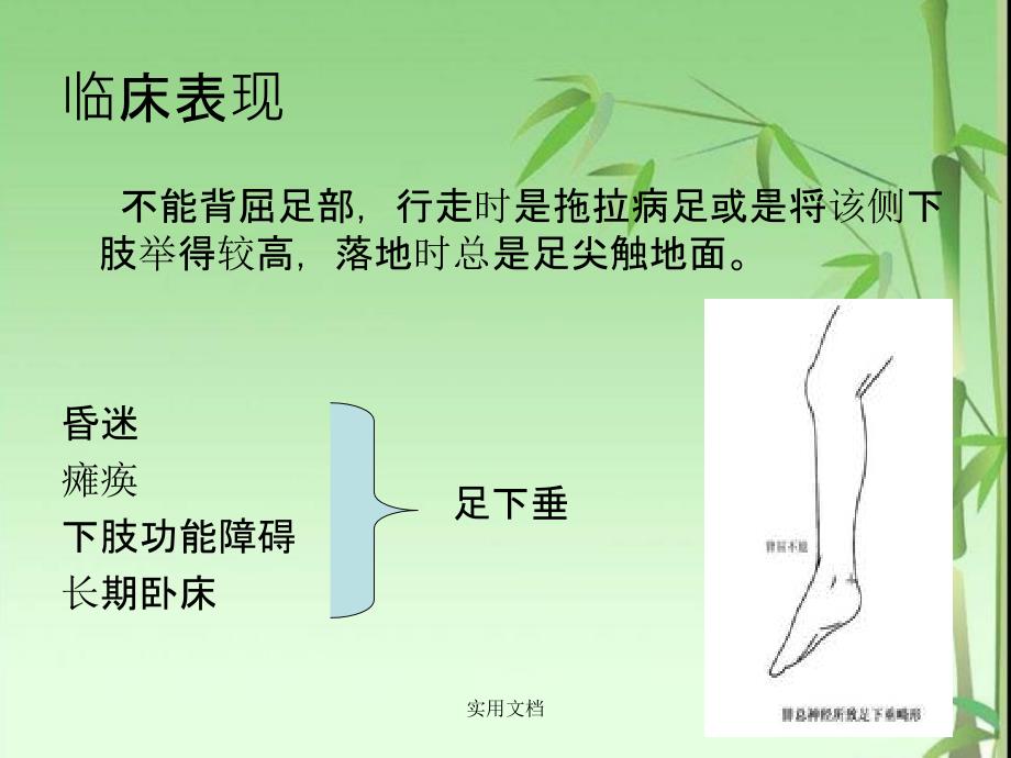 足下垂的预防及护理课件_第3页