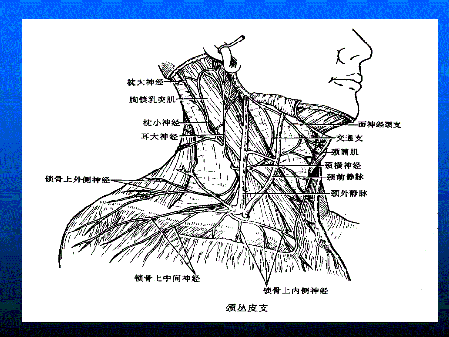 臂丛颈丛神经阻滞麻醉_第3页