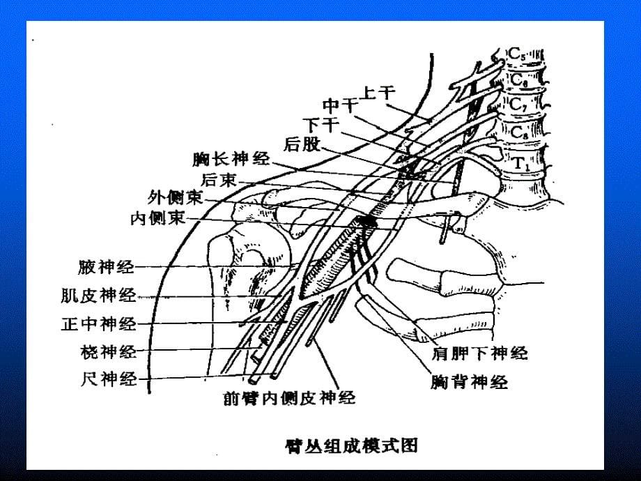 臂丛颈丛神经阻滞麻醉_第5页