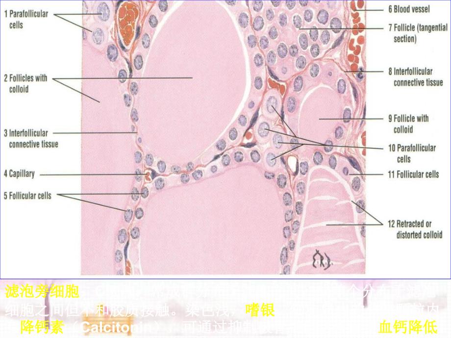 研究生入学考试病理学课件第十三章内分泌系统疾病_第4页