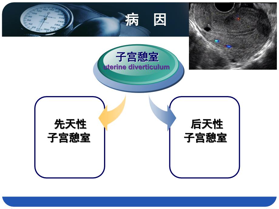 子宫剖宫产瘢痕憩室_第4页