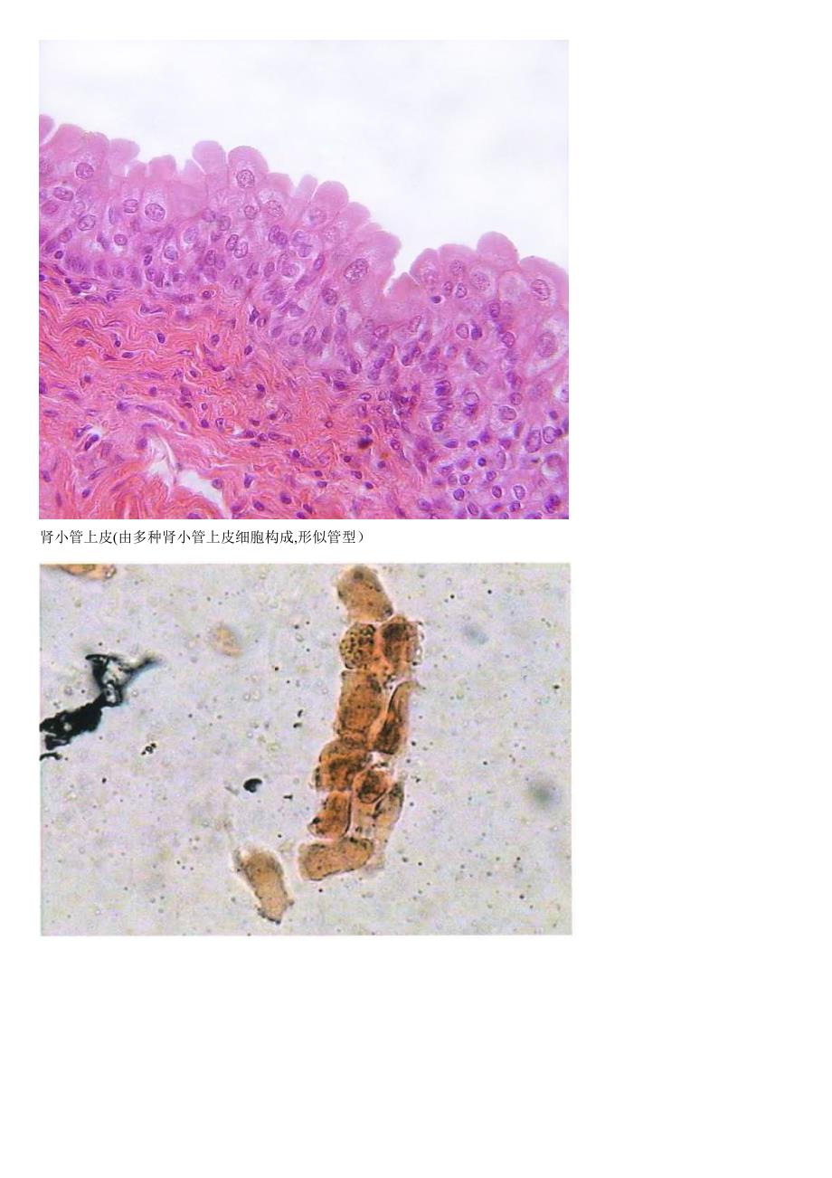 尿沉渣图谱第二册_第4页