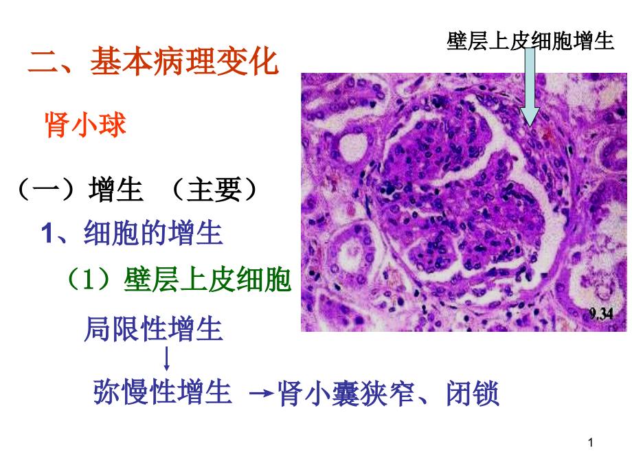 病理学专升本资料：肾炎基本病变_第1页