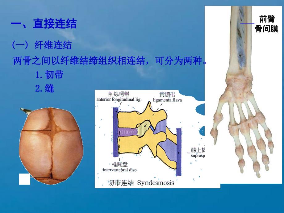 关节学ppt课件_第4页