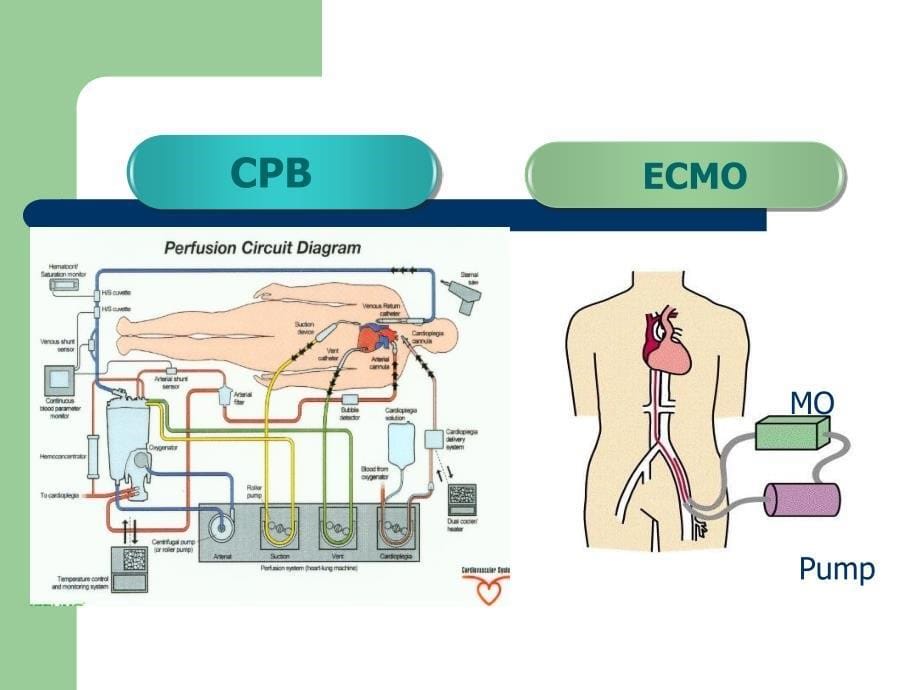 ecmo抗凝及凝血ppt课件_第5页