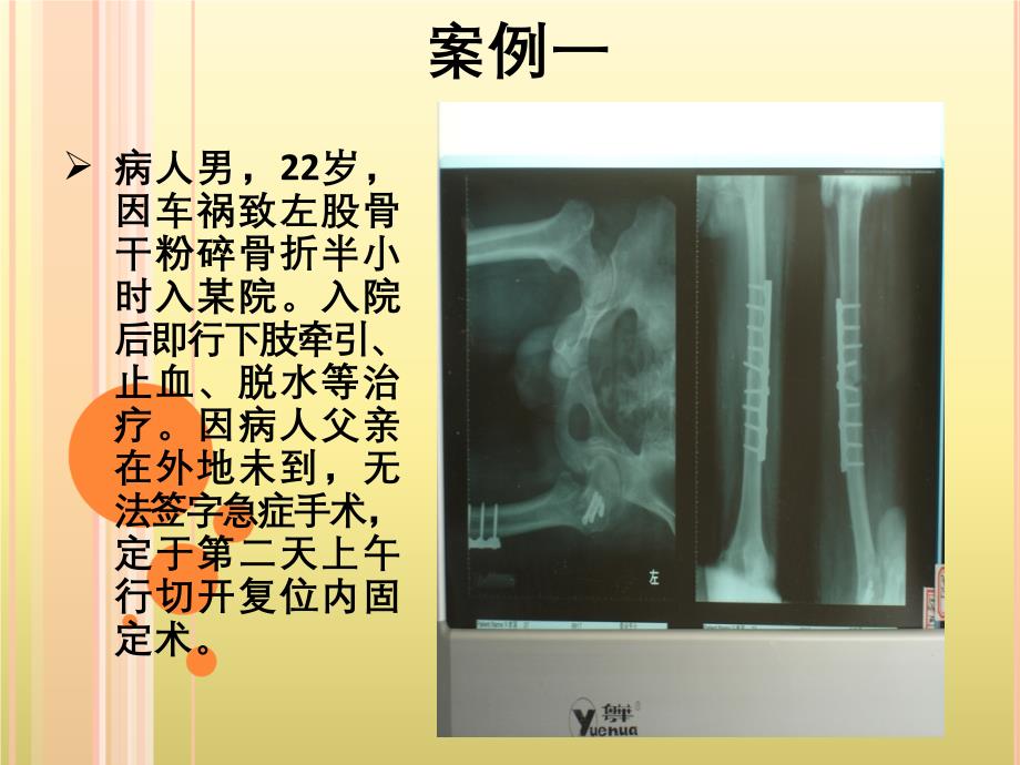 骨科手术纠纷案例分析课件_第4页