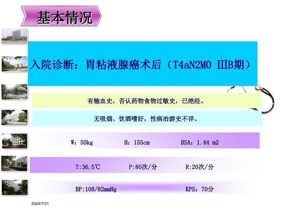 刘利艳-胃癌术后炎性肠梗阻病例讨论课件_第5页