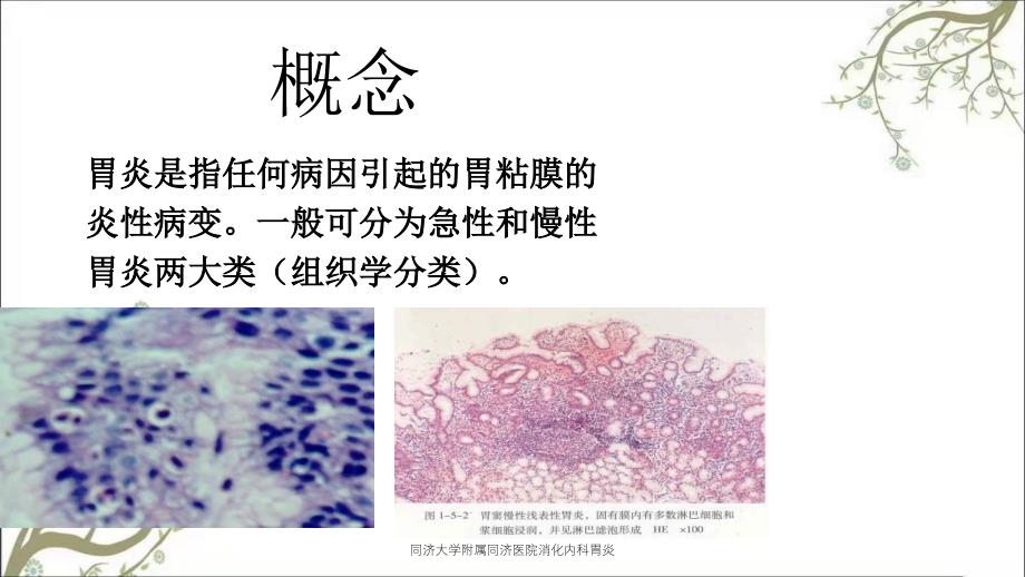 同济大学附属同济医院消化内科胃炎_第2页