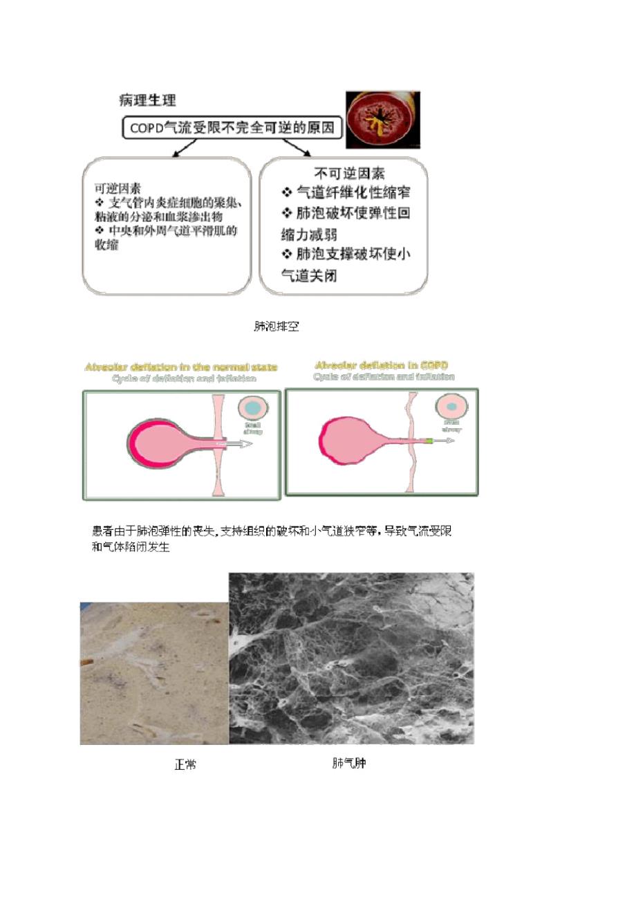 慢性阻塞性肺病和慢性肺源性心脏病_第2页