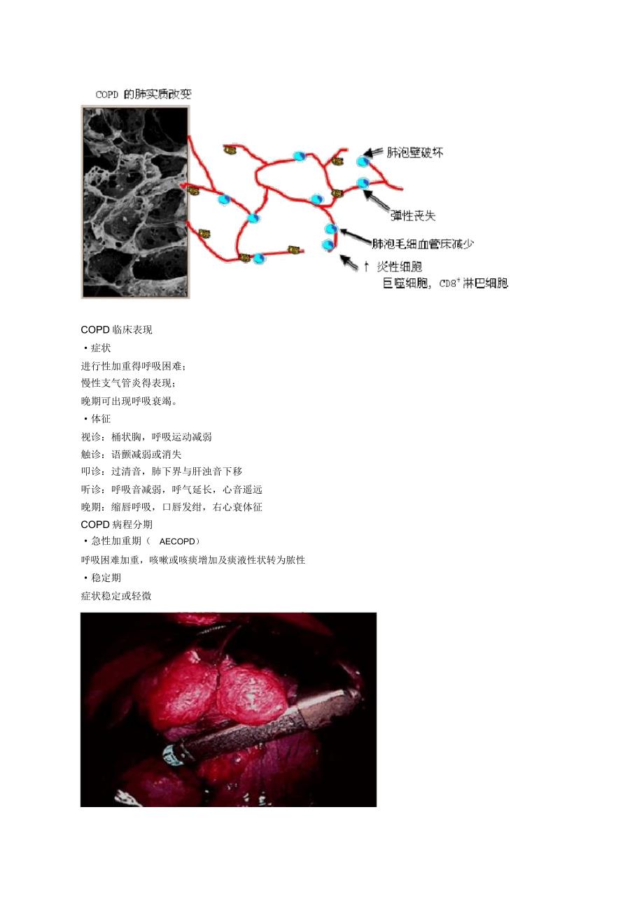 慢性阻塞性肺病和慢性肺源性心脏病_第3页