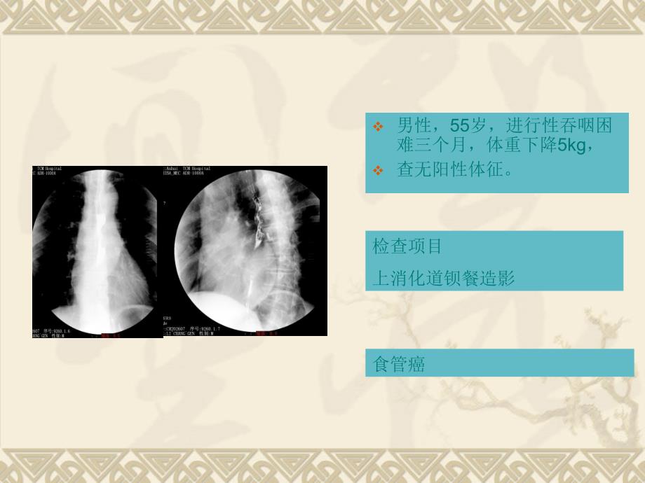 影像典型图片ppt课件_第2页