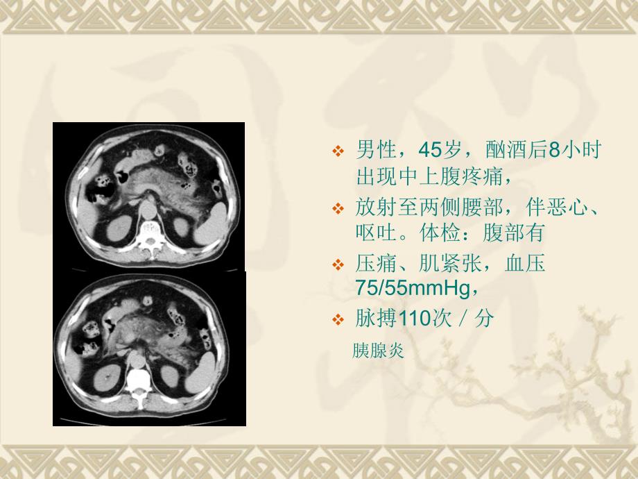 影像典型图片ppt课件_第4页