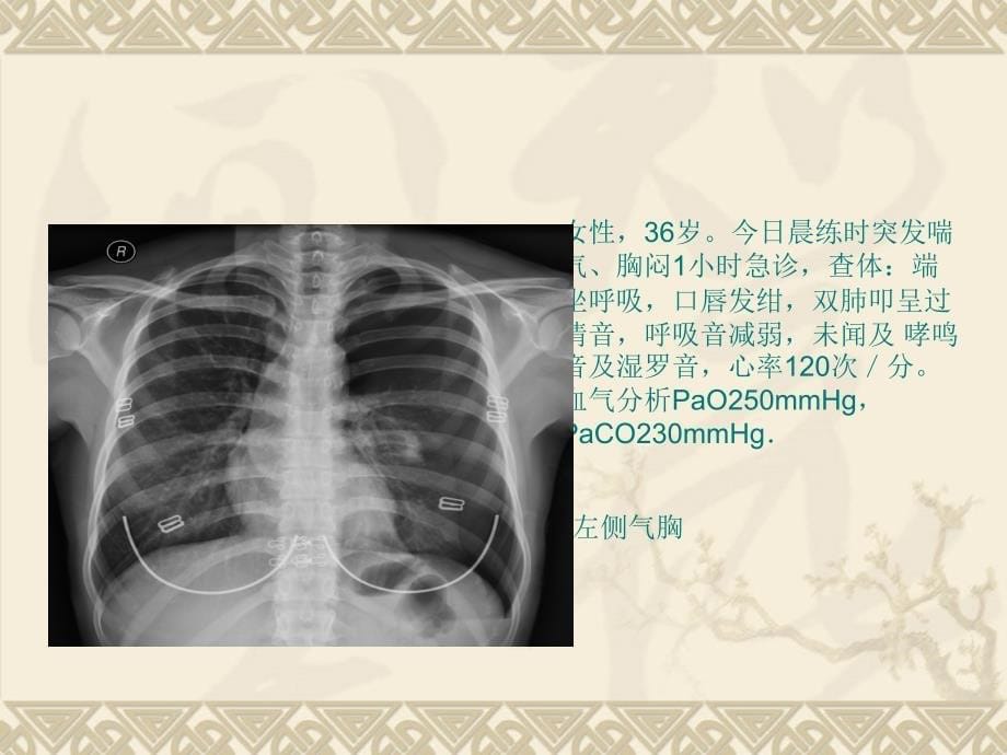 影像典型图片ppt课件_第5页