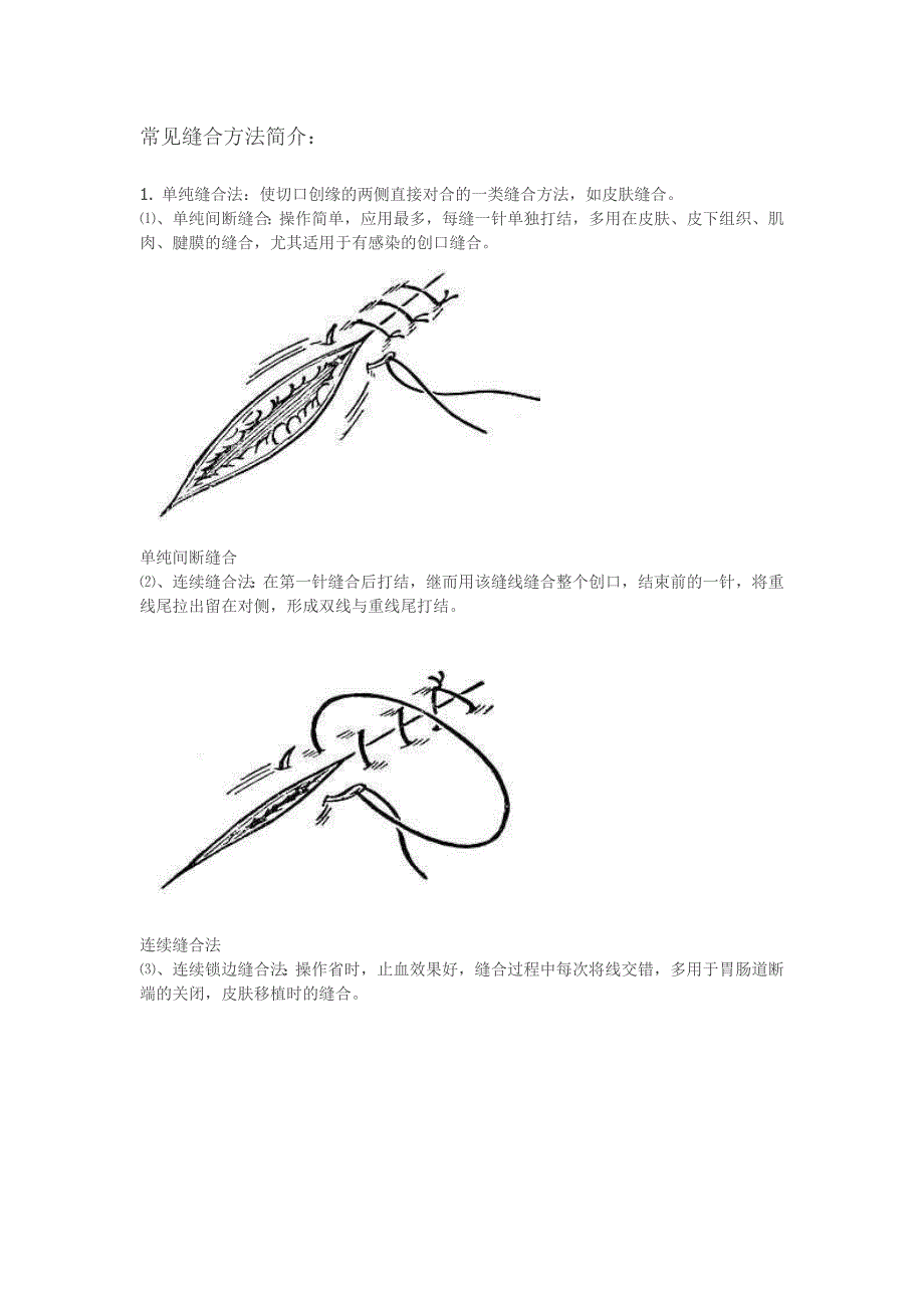 缝合技巧讲解(精品)_第1页