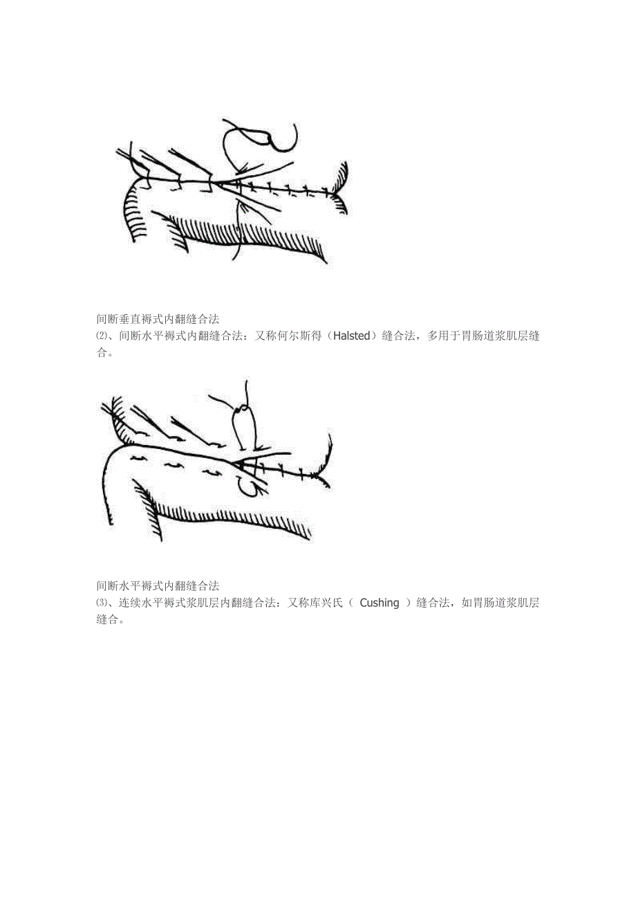 缝合技巧讲解(精品)_第3页