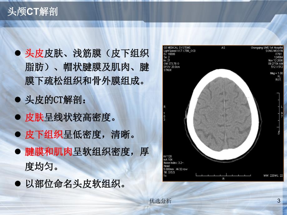 头颅CT常见疾病[深度特制]_第3页