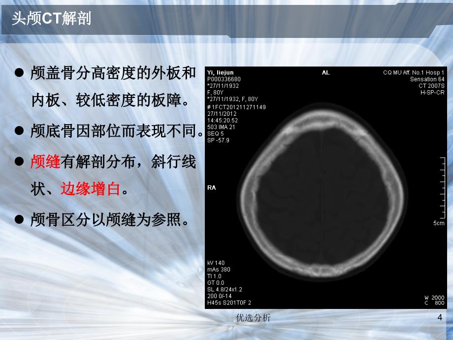 头颅CT常见疾病[深度特制]_第4页