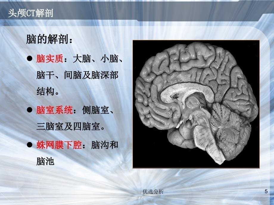 头颅CT常见疾病[深度特制]_第5页