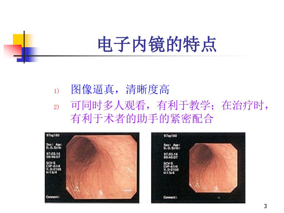 结肠镜PPT参考幻灯片_第3页