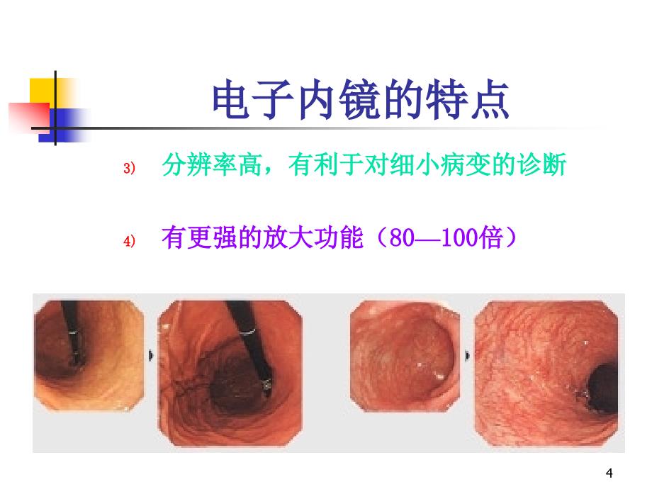 结肠镜PPT参考幻灯片_第4页