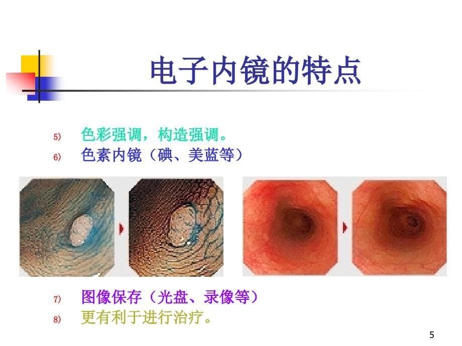 结肠镜PPT参考幻灯片_第5页