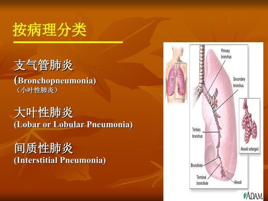 医学类教学课件：支气管肺炎_第5页