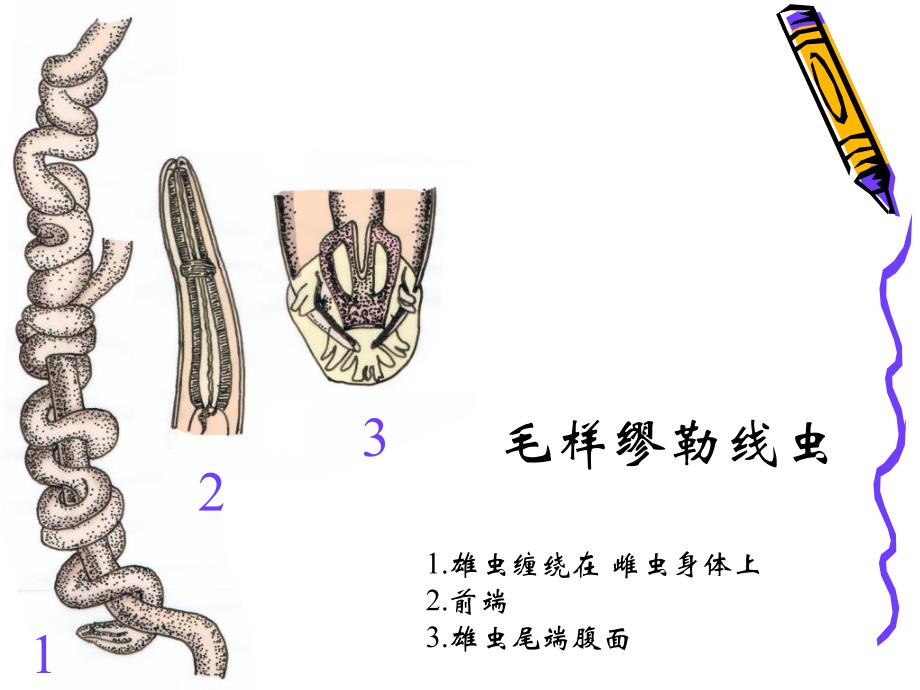 原圆科线虫病_第4页