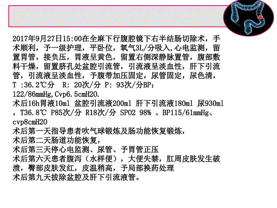 结肠癌的护理查房_第4页