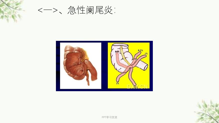 急腹症的超声诊断与鉴别诊断ppt课件_第4页