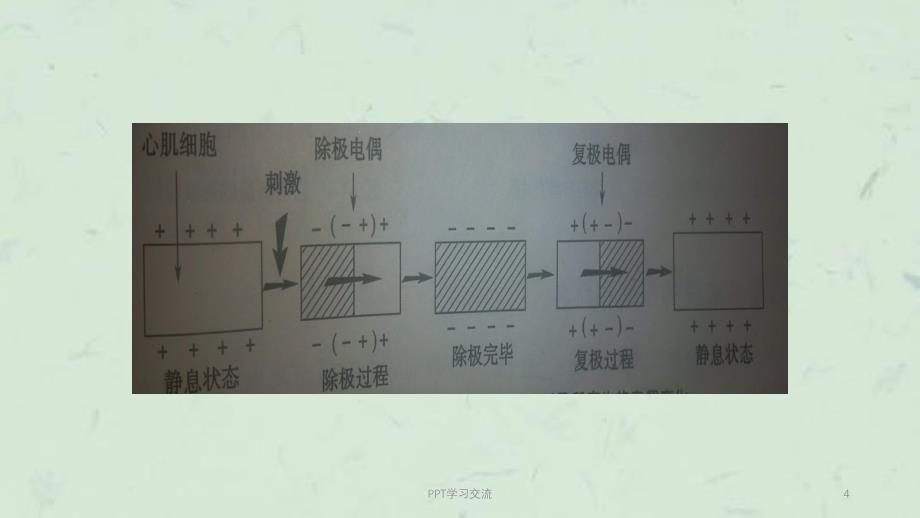 常见心律失常的心电图识别课件_第4页